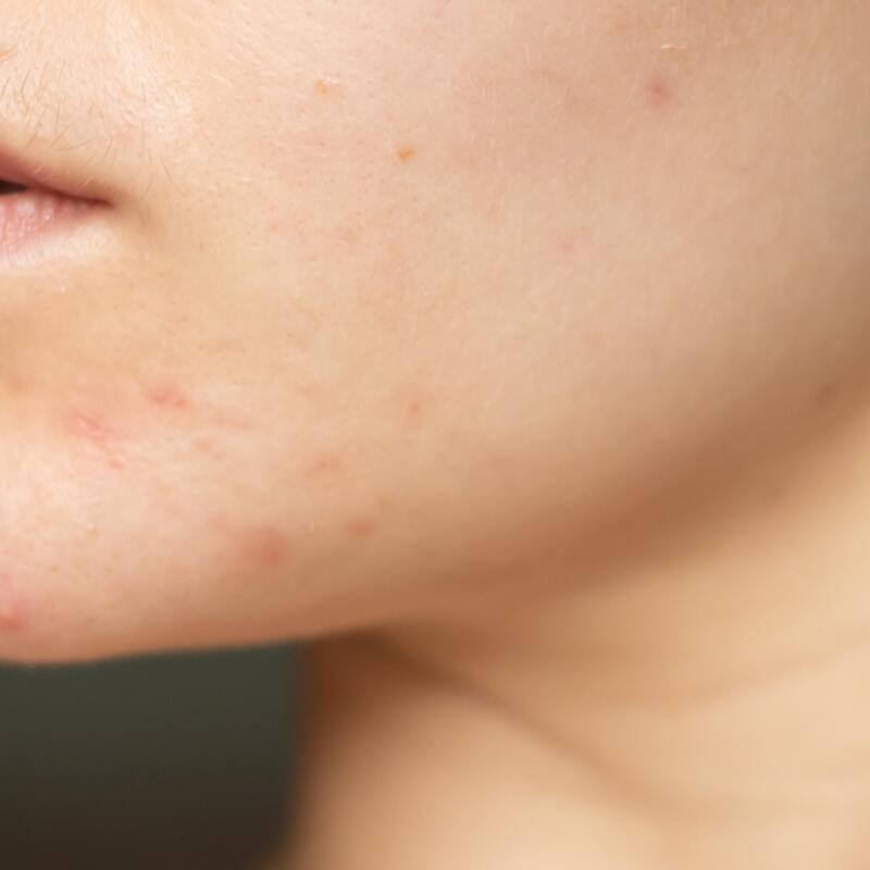 TND AUG Blog 1 x2 5 Hydrating vs Stripping: How to Choose the Right Toner for Combination Skin TND AUG Blog 1 x2 5